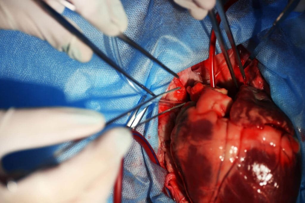 Ictus Cardiologia - Liderando em Prevenção e Performance Cardíaca - Descubra como a Ictus Cardiologia em Natal, RN, transforma a prevenção em performance cardíaca. Marque sua consulta e viva mais e melhor. Cateterismo Cardíaco